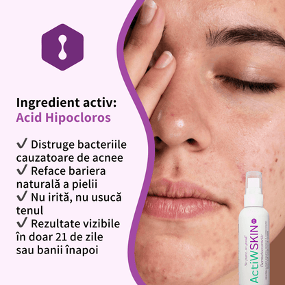 ActiW SKIN - PENTRU ACNEE - Pachet mic - Tratament 12-15 zile